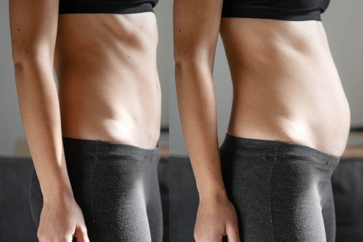 How long does diastasis recti take to improve Busby?