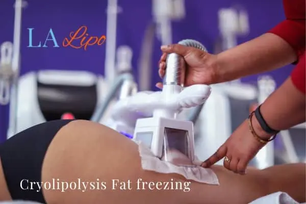 women getting fat freezing Busby