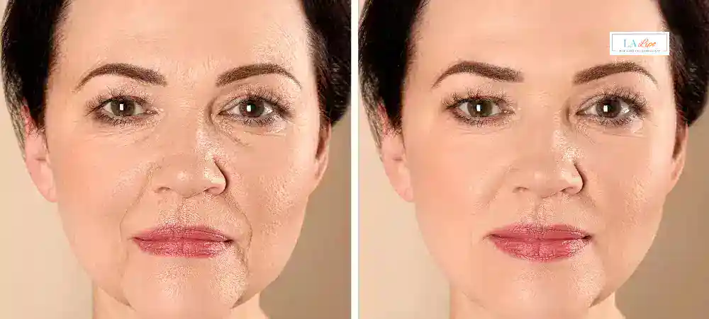 Why Aren’t My Skincare Products Making My Sagging Skin Look Firmer Busby?